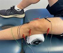 Dry Needling
